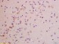 NDUFS1 Polyclonal Antibody